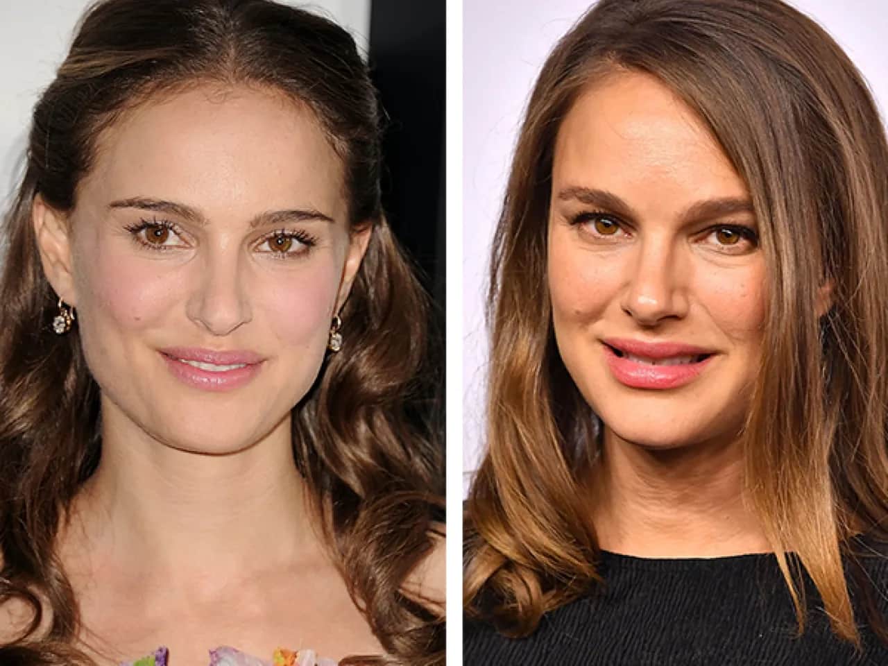 Natürliche Lippenschattierung: Vorher-Nachher für Traumlippen